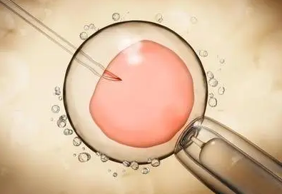 包生男孩公司试管婴儿中心